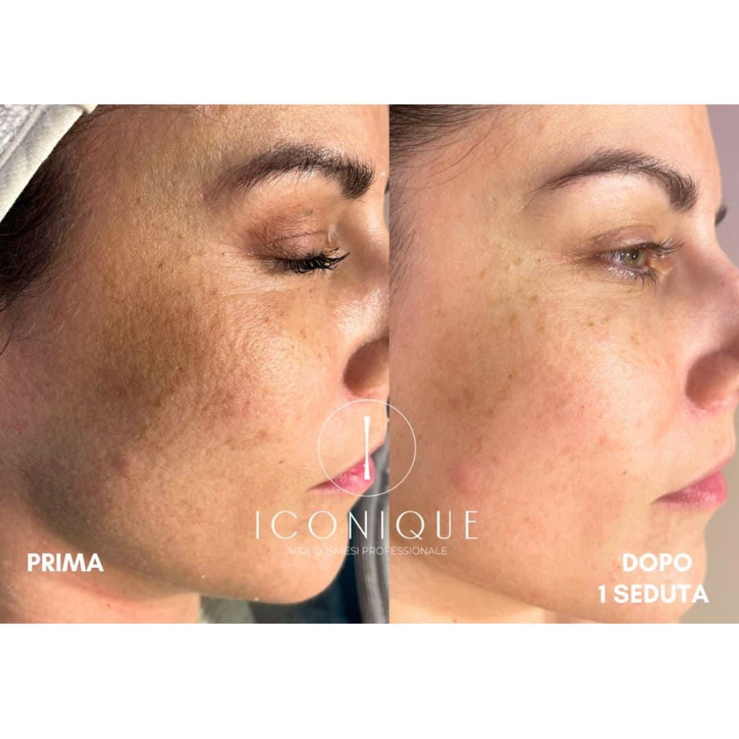 risultati-iconique-1