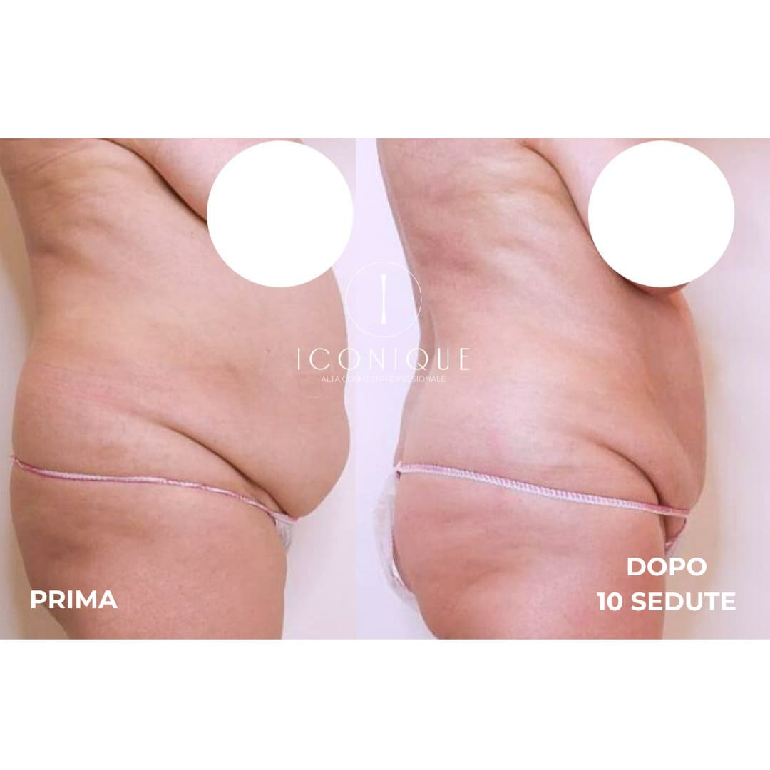 risultati-iconique-11
