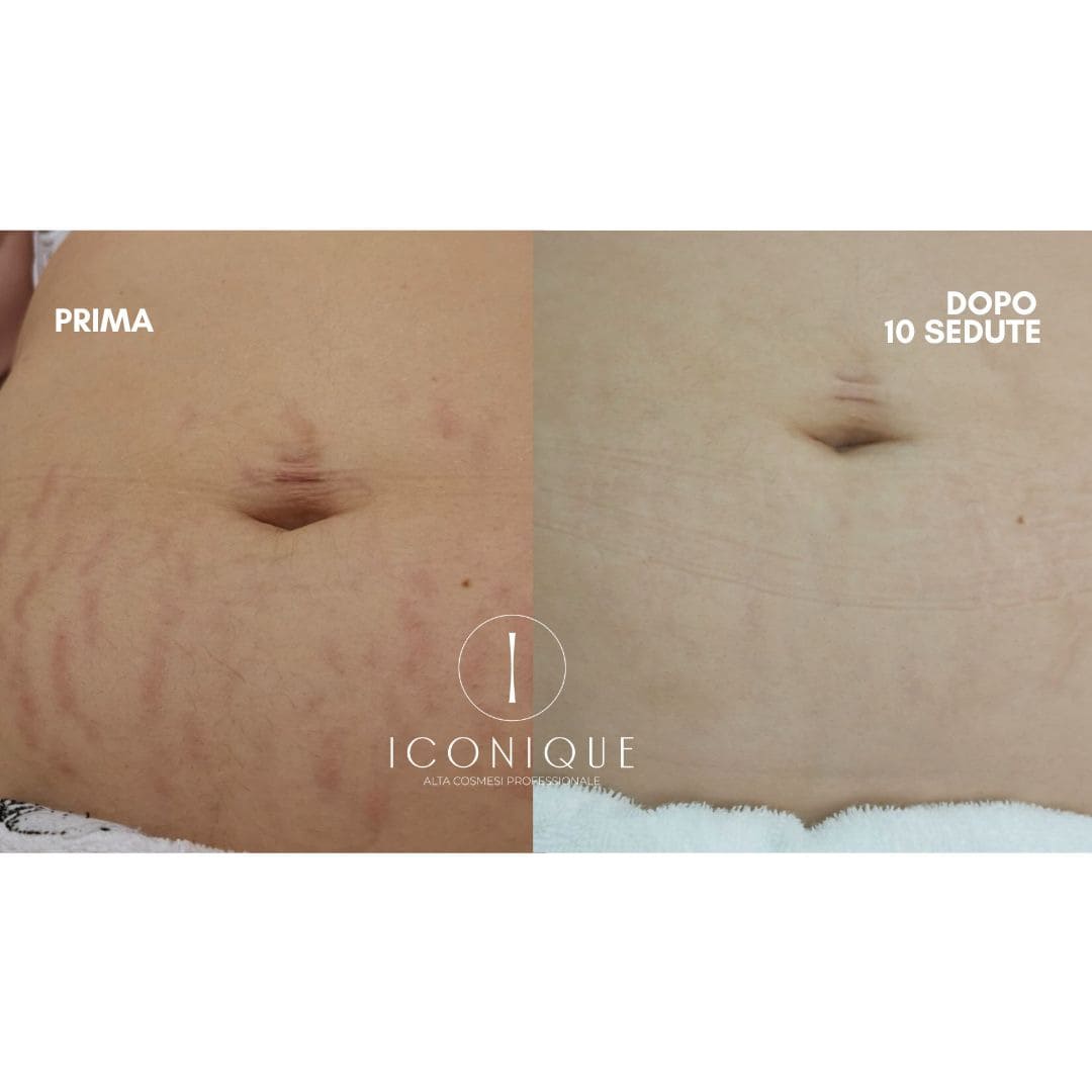 risultati-iconique-12