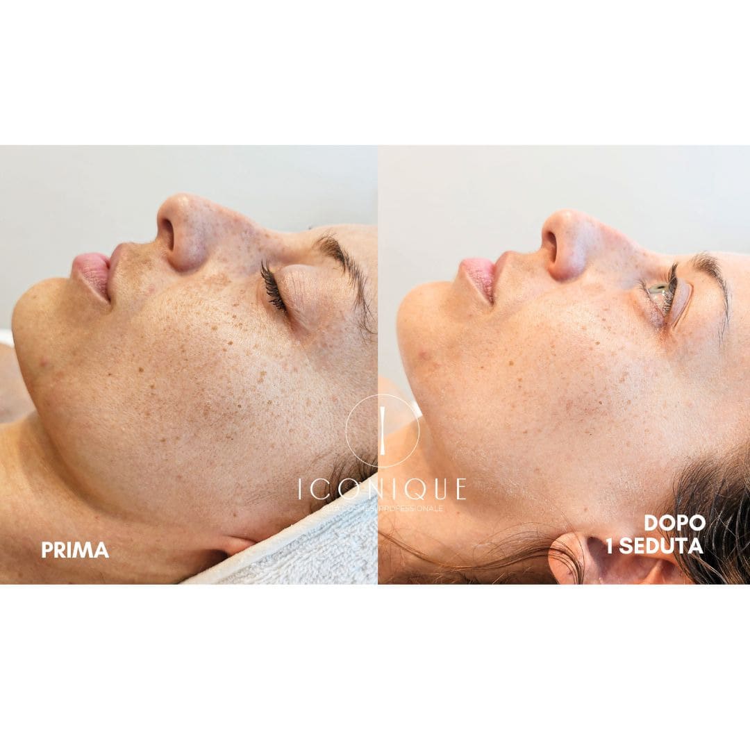 risultati-iconique-14