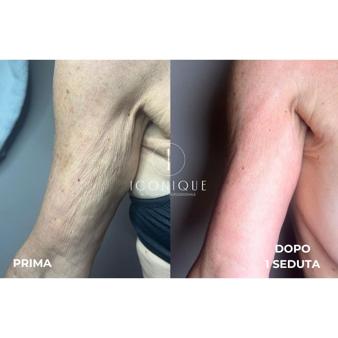 risultati-iconique-15