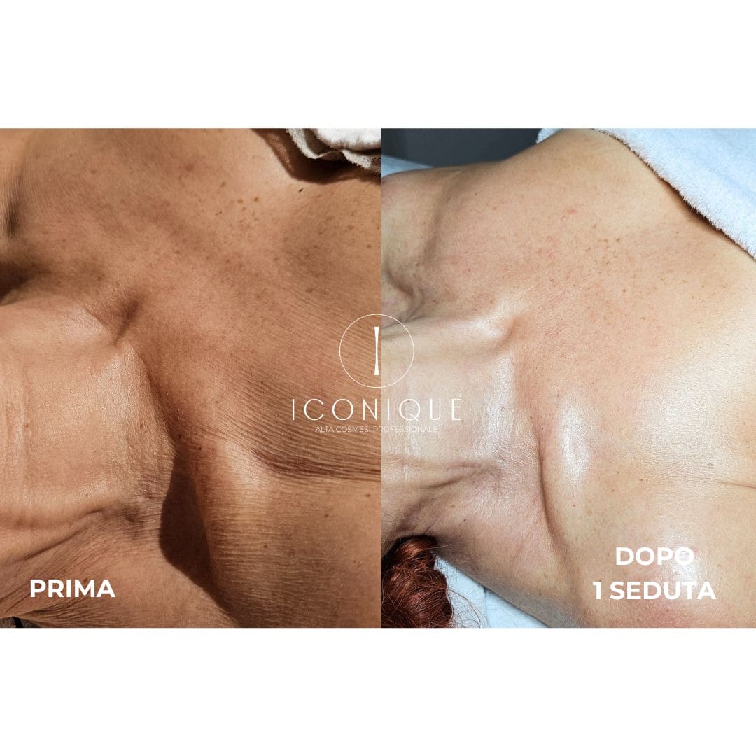 risultati-iconique-16