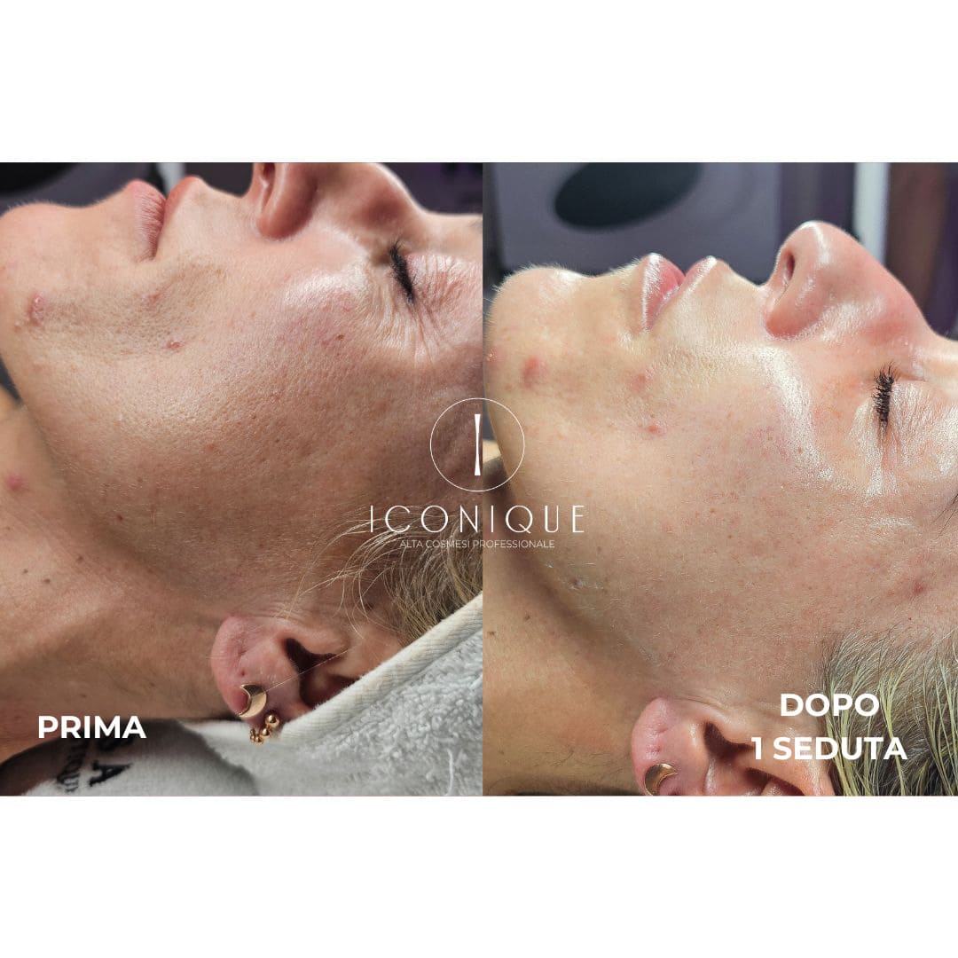 risultati-iconique-18
