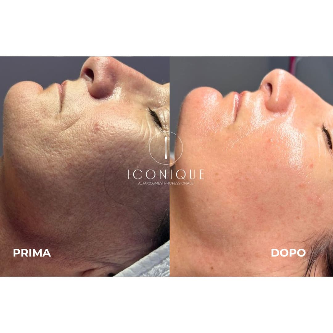 risultati-iconique-19