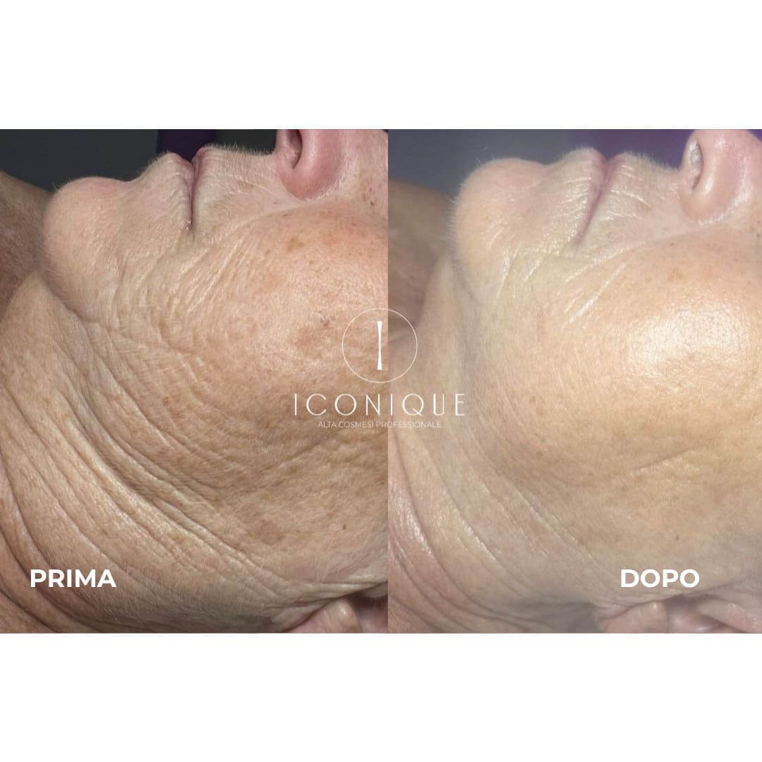 risultati-iconique-20