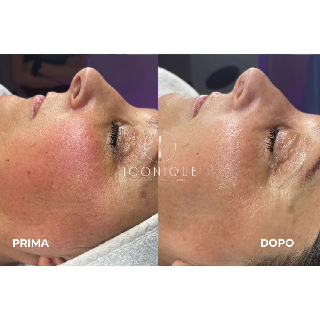 risultati-iconique-21