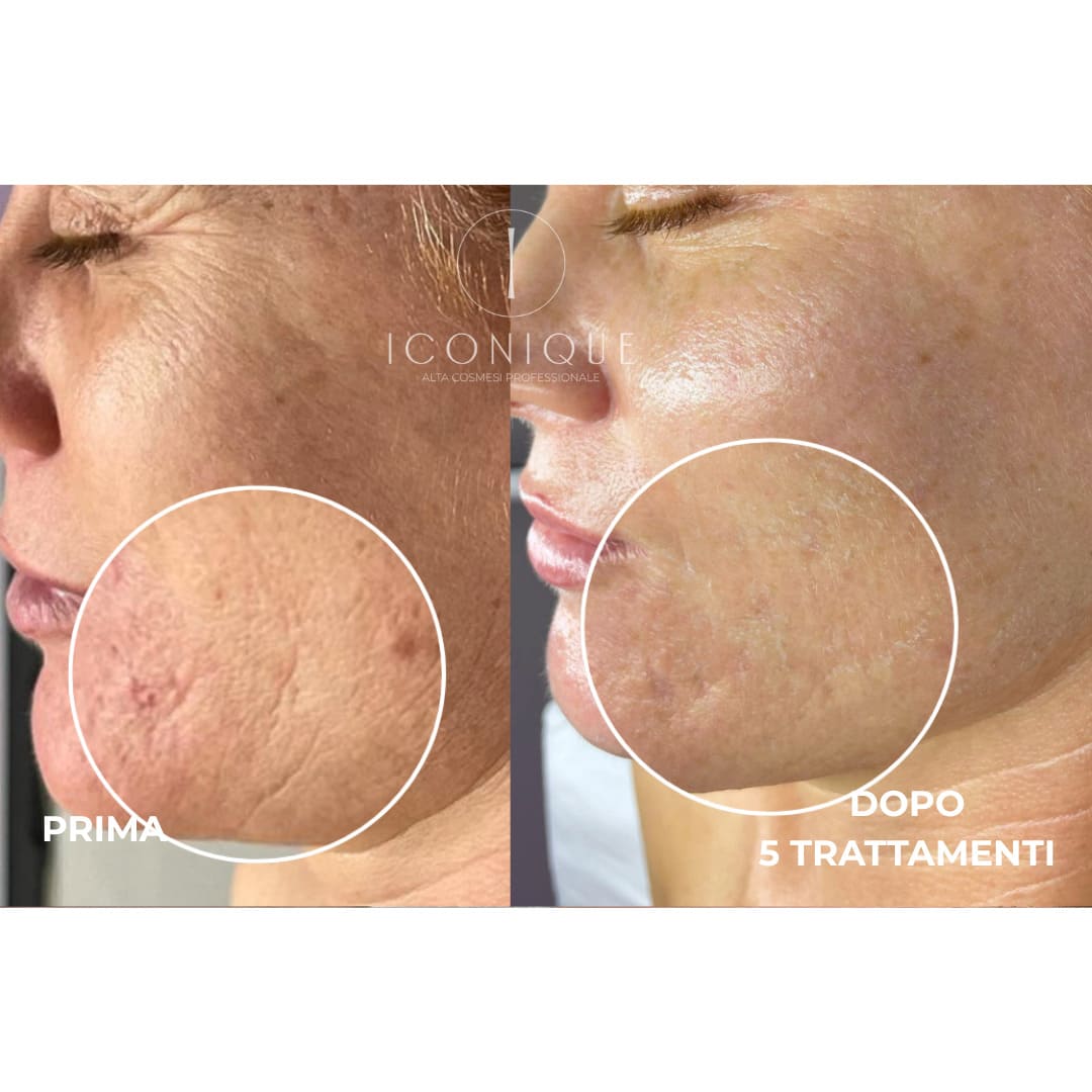 risultati-iconique-22