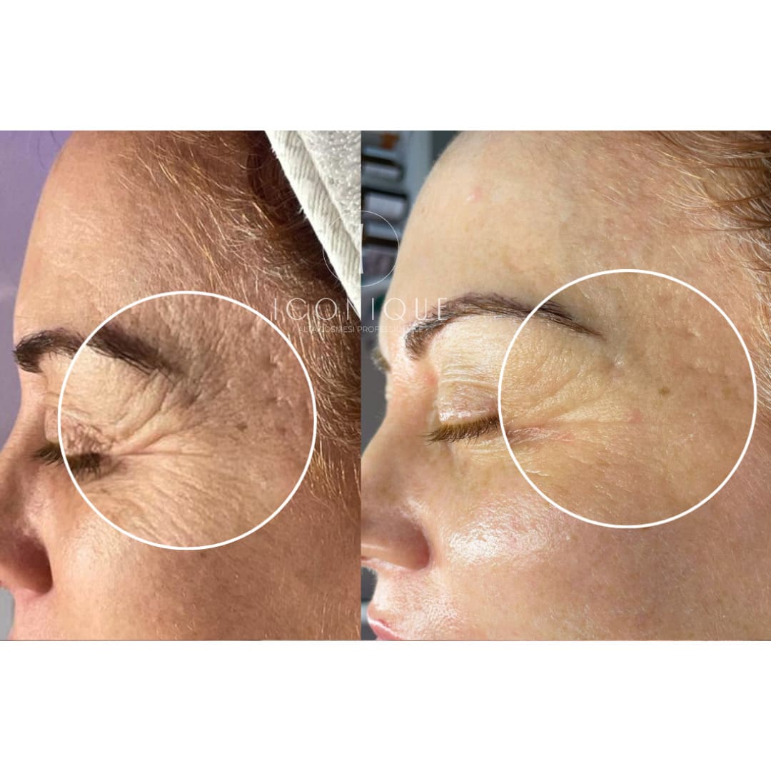 risultati-iconique-23