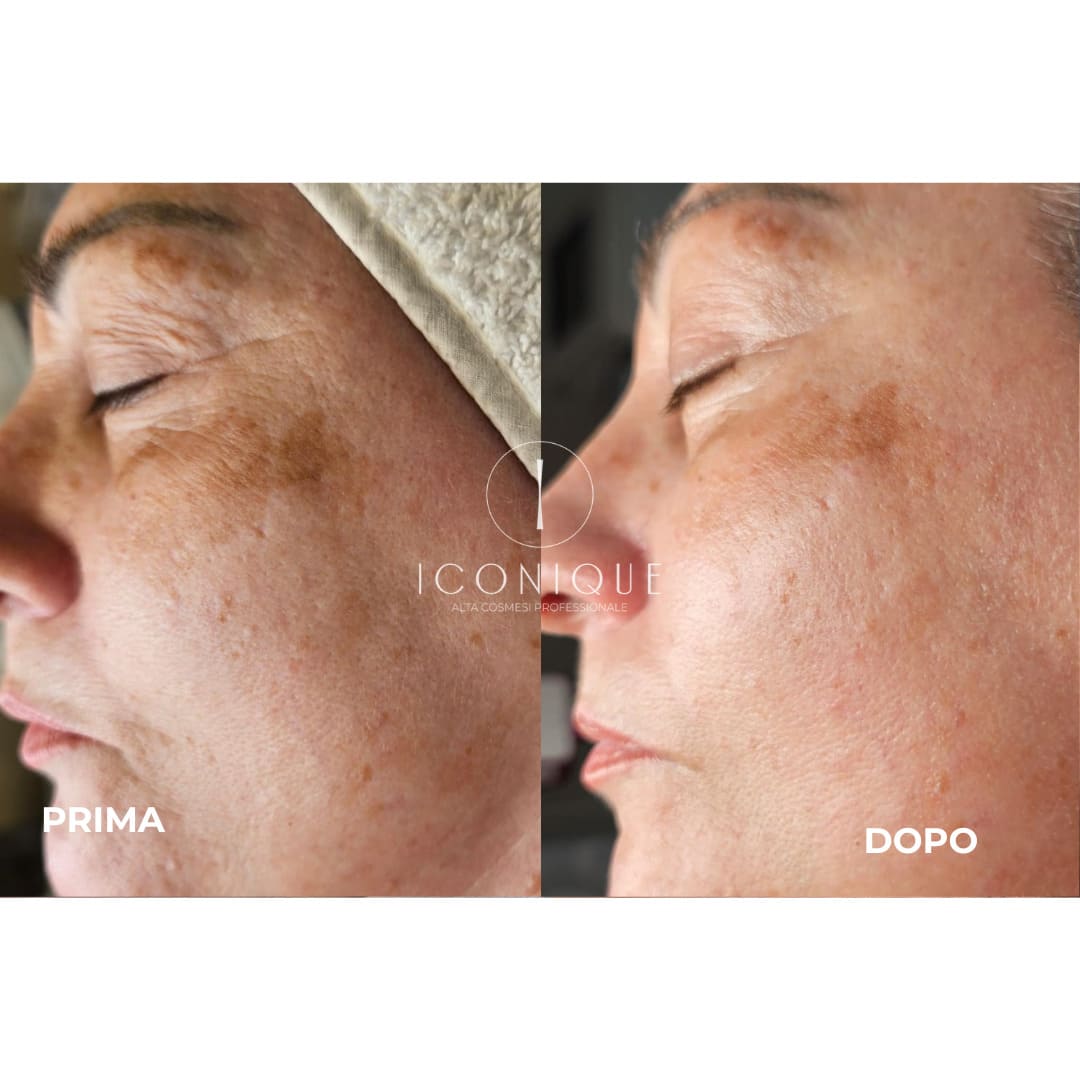 risultati-iconique-24