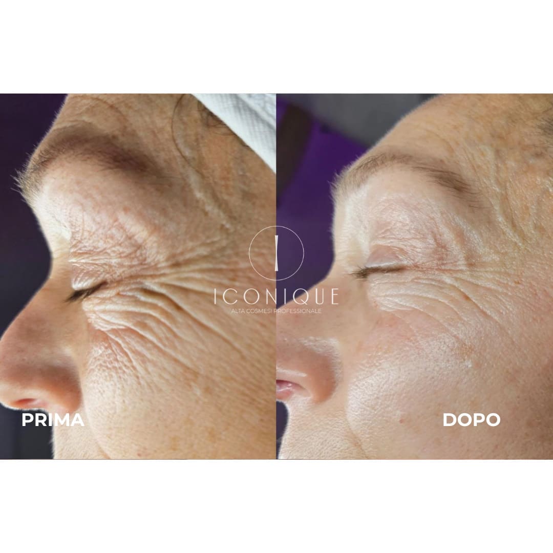 risultati-iconique-26