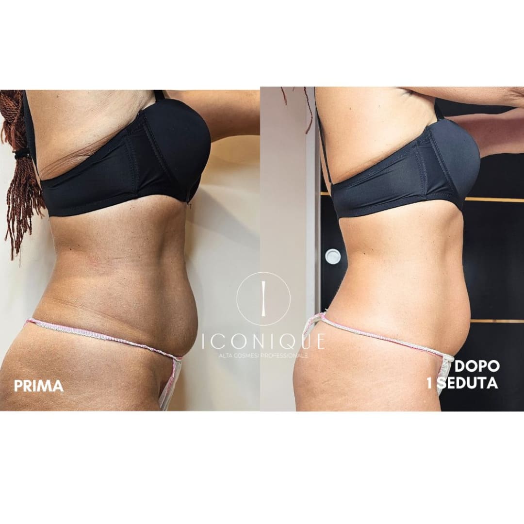 risultati-iconique-3