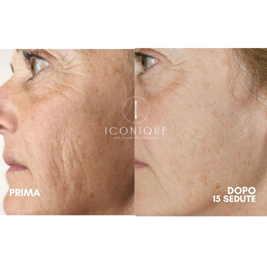 risultati-iconique-4