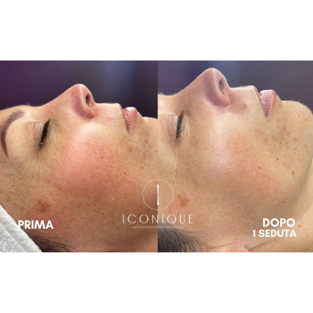 risultati-iconique-5
