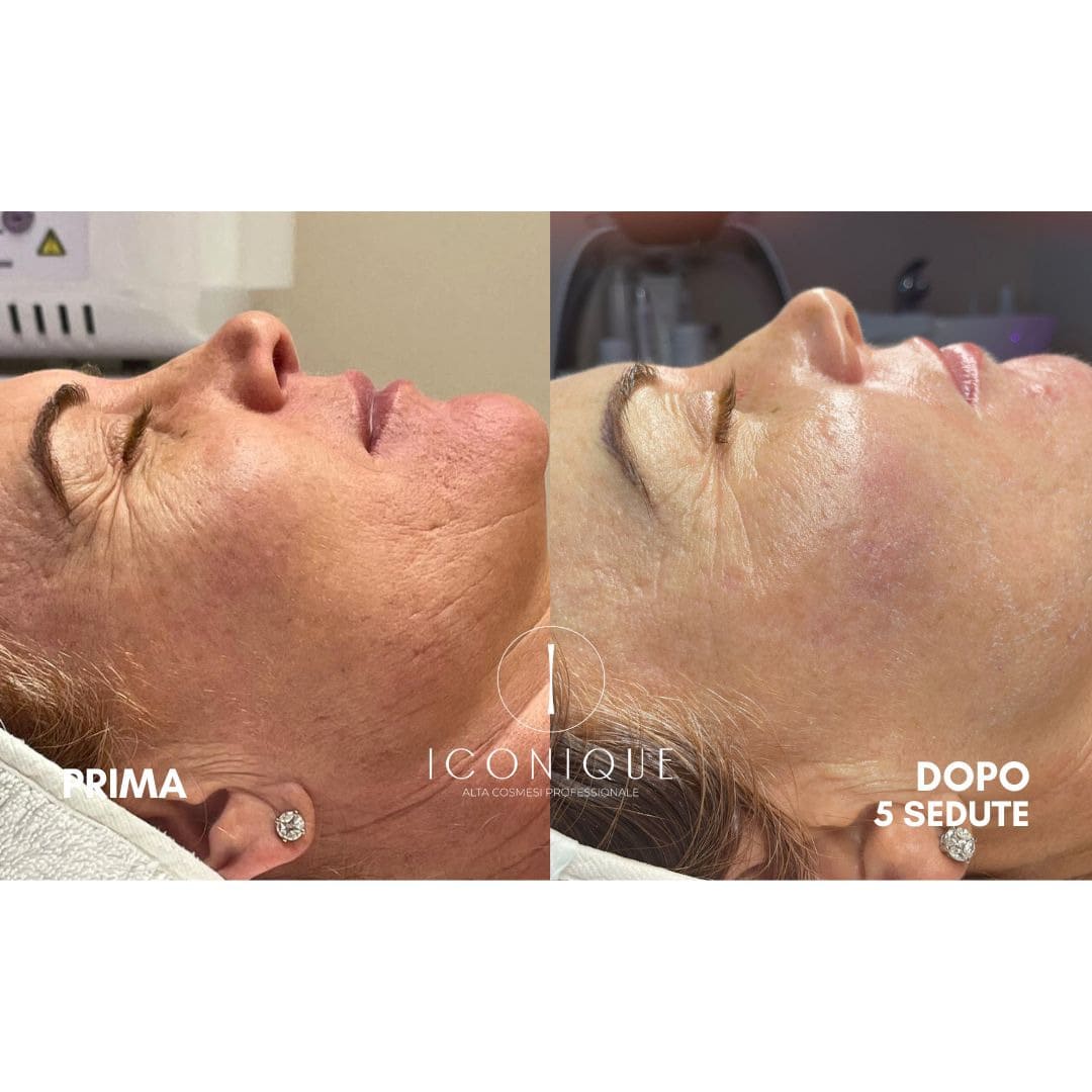 risultati-iconique-6