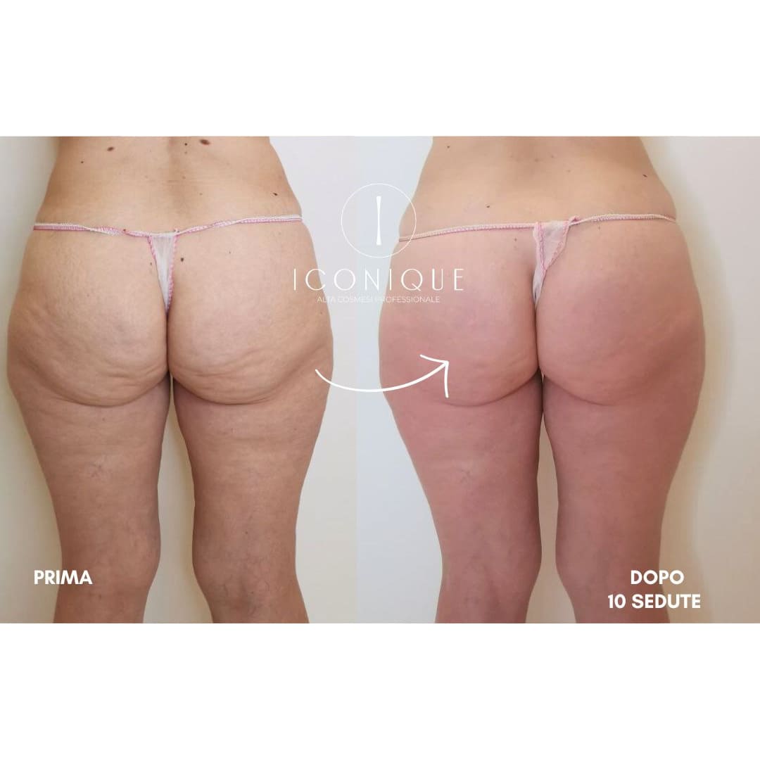 risultati-iconique-8